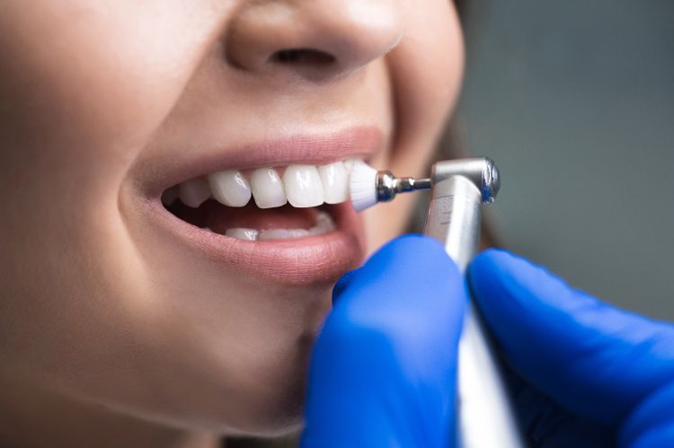 dental-hygiene-cgs-dentistry-service